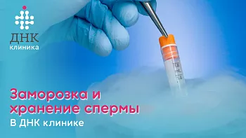 Заморозка и хранение спермы? 