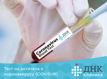 Анализ на антитела к коронавирусу (COVID-19)